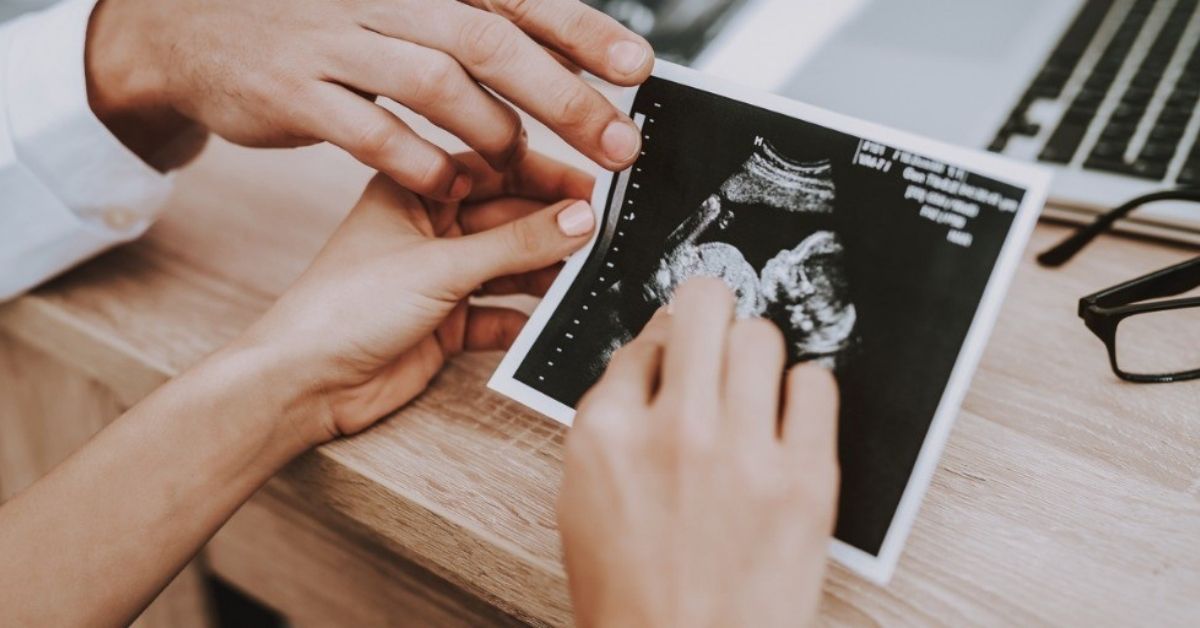 Hands of a man and a woman hold a sonogram of a baby